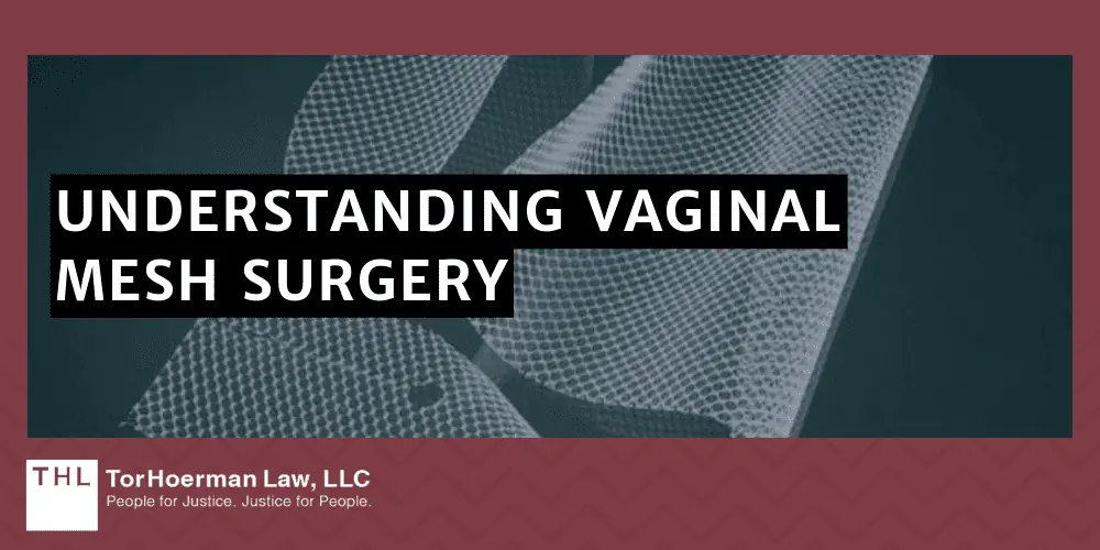 Understanding Vaginal Mesh Surgery
