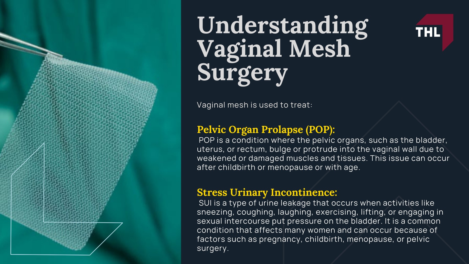 Understanding Vaginal Mesh Surgery