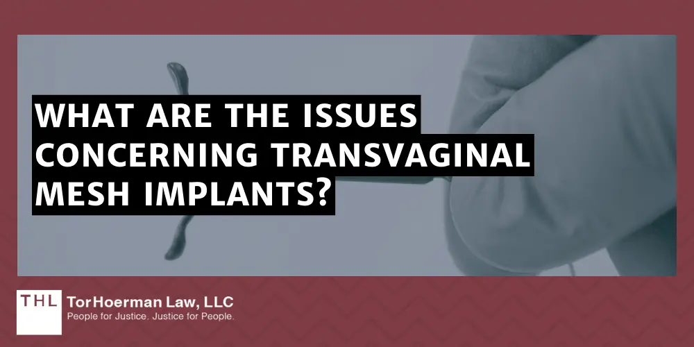 Transvaginal Mesh Recall; Transvaginal Mesh Lawsuit; Vaginal Mesh Lawsuit; Transvaginal Mesh Lawsuits; Vaginal Mesh Lawyers; Transvaginal Mesh Lawyers; What Are The Issues Concerning Transvaginal Mesh Implants