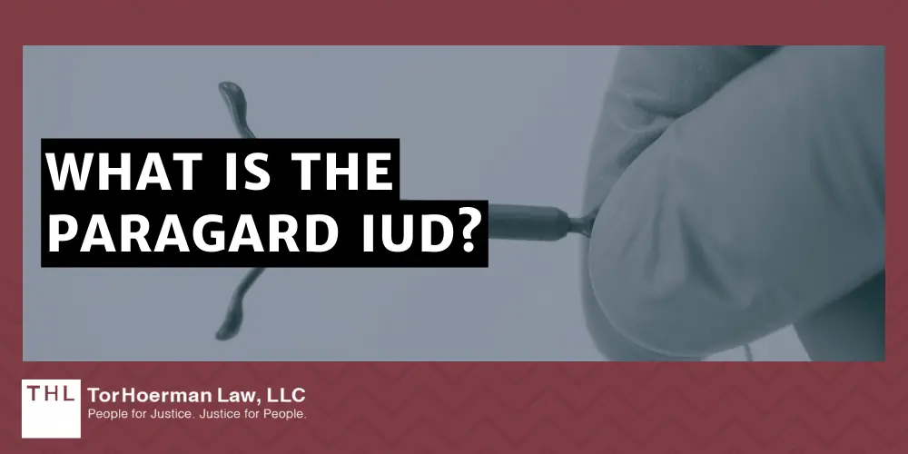 Paragard IUD Injury; Paragard Lawsuit; Paragard IUD Lawsuits; Paragard IUD Injury Lawsuits; Paragard Lawyers; What Is The Paragard IUD