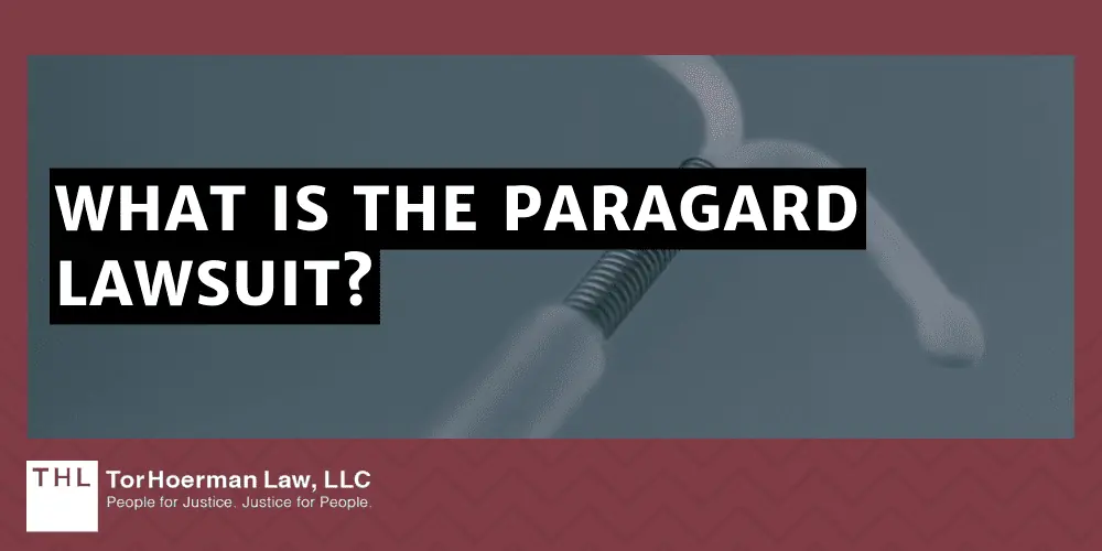 What Is The Paragard Lawsuit