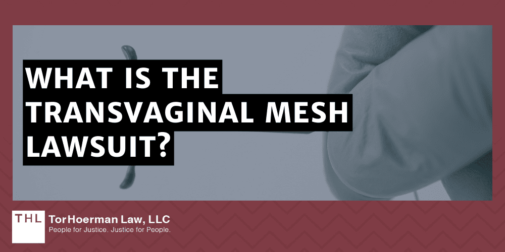 Transvaginal Mesh Lawsuit; Vaginal Mesh Lawsuit; Transvaginal Mesh Lawyers; What Is The Transvaginal Mesh Lawsuit
