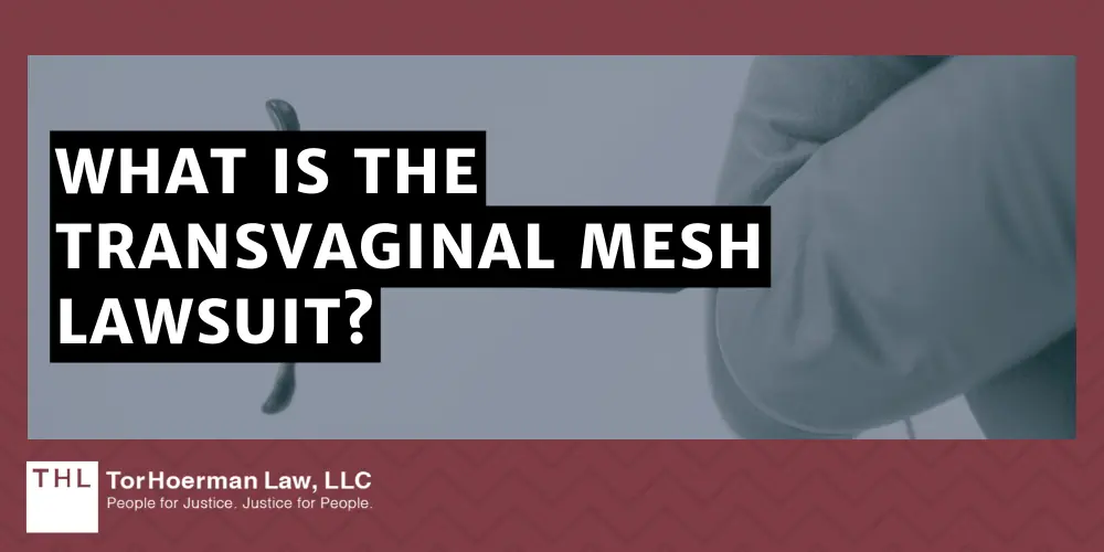 Transvaginal Mesh Lawsuit; Vaginal Mesh Lawsuit; Transvaginal Mesh Lawyers; What Is The Transvaginal Mesh Lawsuit