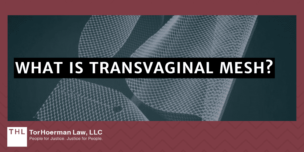 Transvaginal Mesh Complications; Transvaginal Mesh Injuries; Vaginal Mesh Complications; What Is Transvaginal Mesh