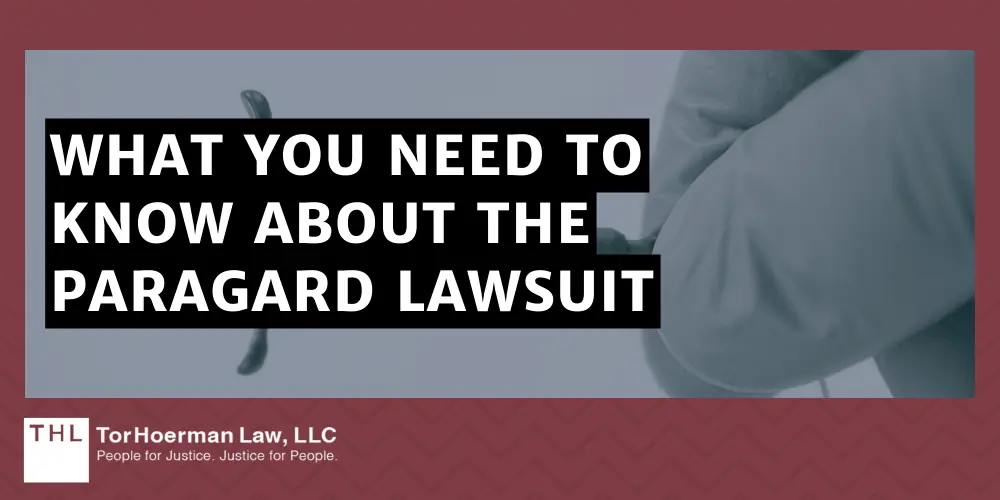 What You Need To Know About The Paragard LawsuitParagard Law