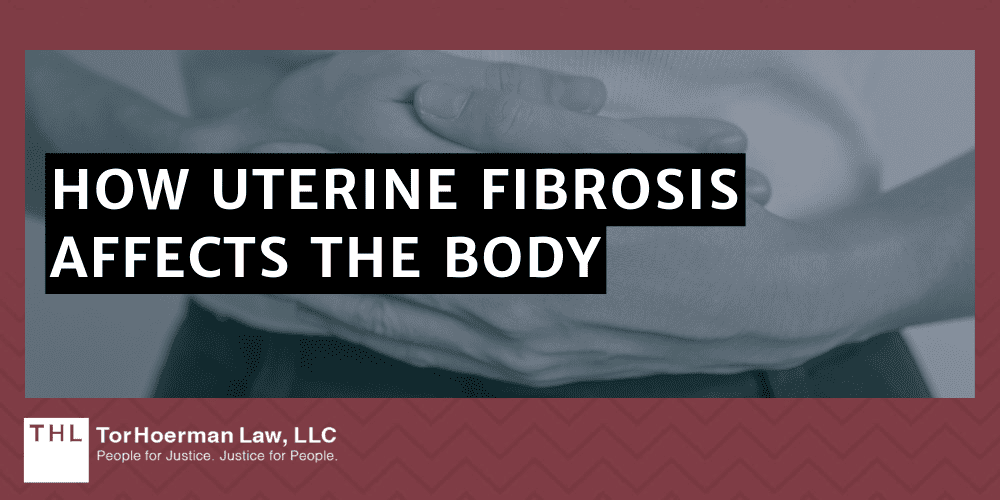How Uterine Fibrosis Affects The Body