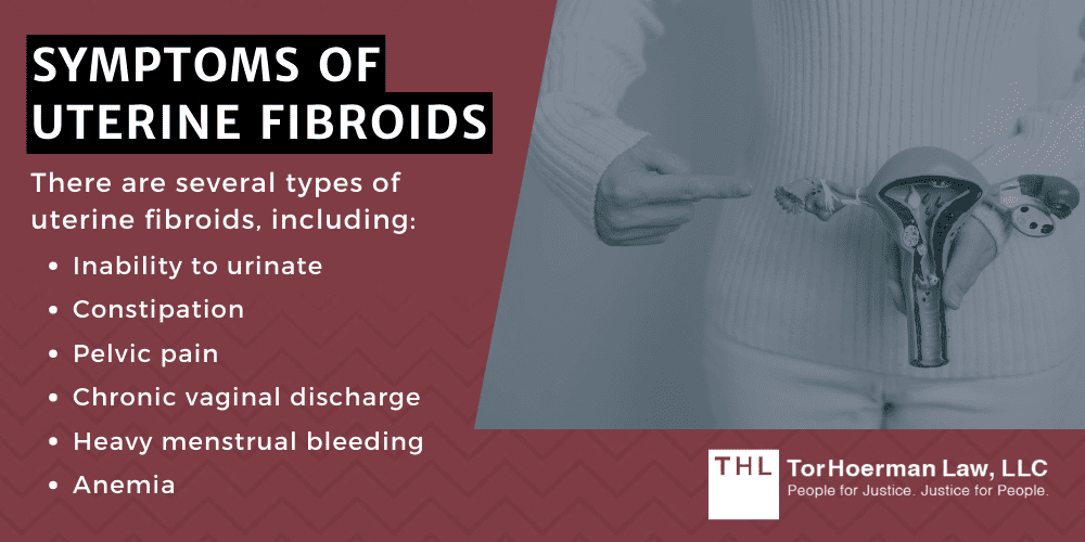Symptoms Of Uterine Fibroids