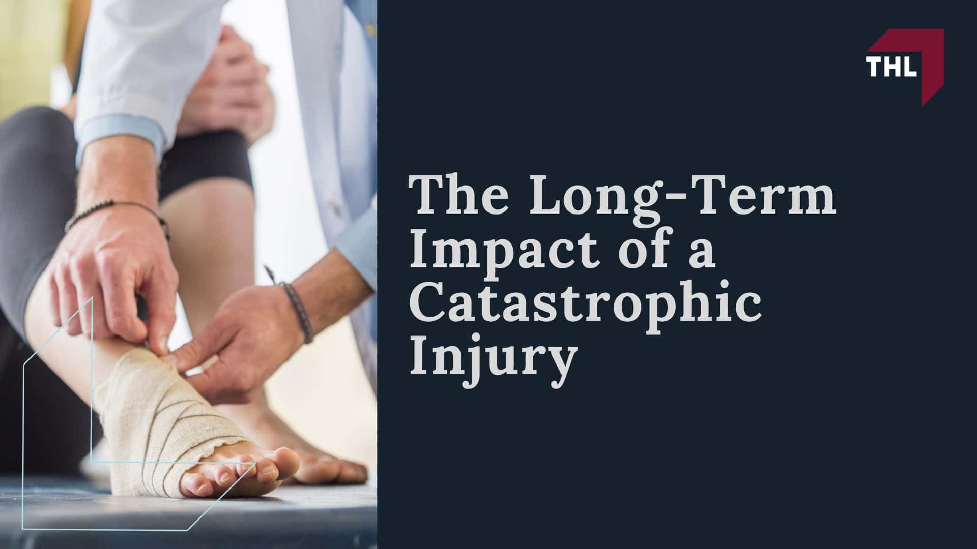 What Is Considered a Catastrophic Injury; How Catastrophic Injuries Differ From Other Personal Injury Claims; Common Causes of Catastrophic Injuries in St Louis; The Long-Term Impact of a Catastrophic Injury