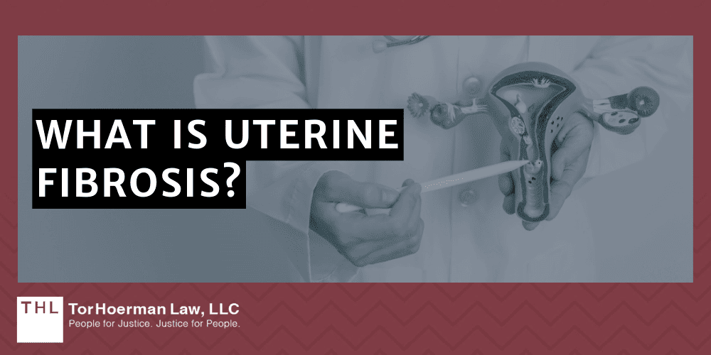 What Is Uterine Fibrosis
