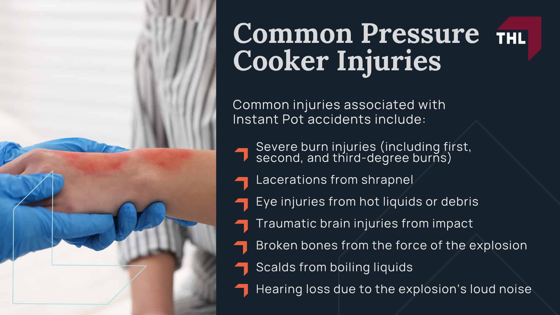 Legal Action for People Injured by Instant Pot Pressure Cookers; Who Can File an Instant Pot Lawsuit; How Does an Instant Pot Explosion Happen;  Common Pressure Cooker Injuries