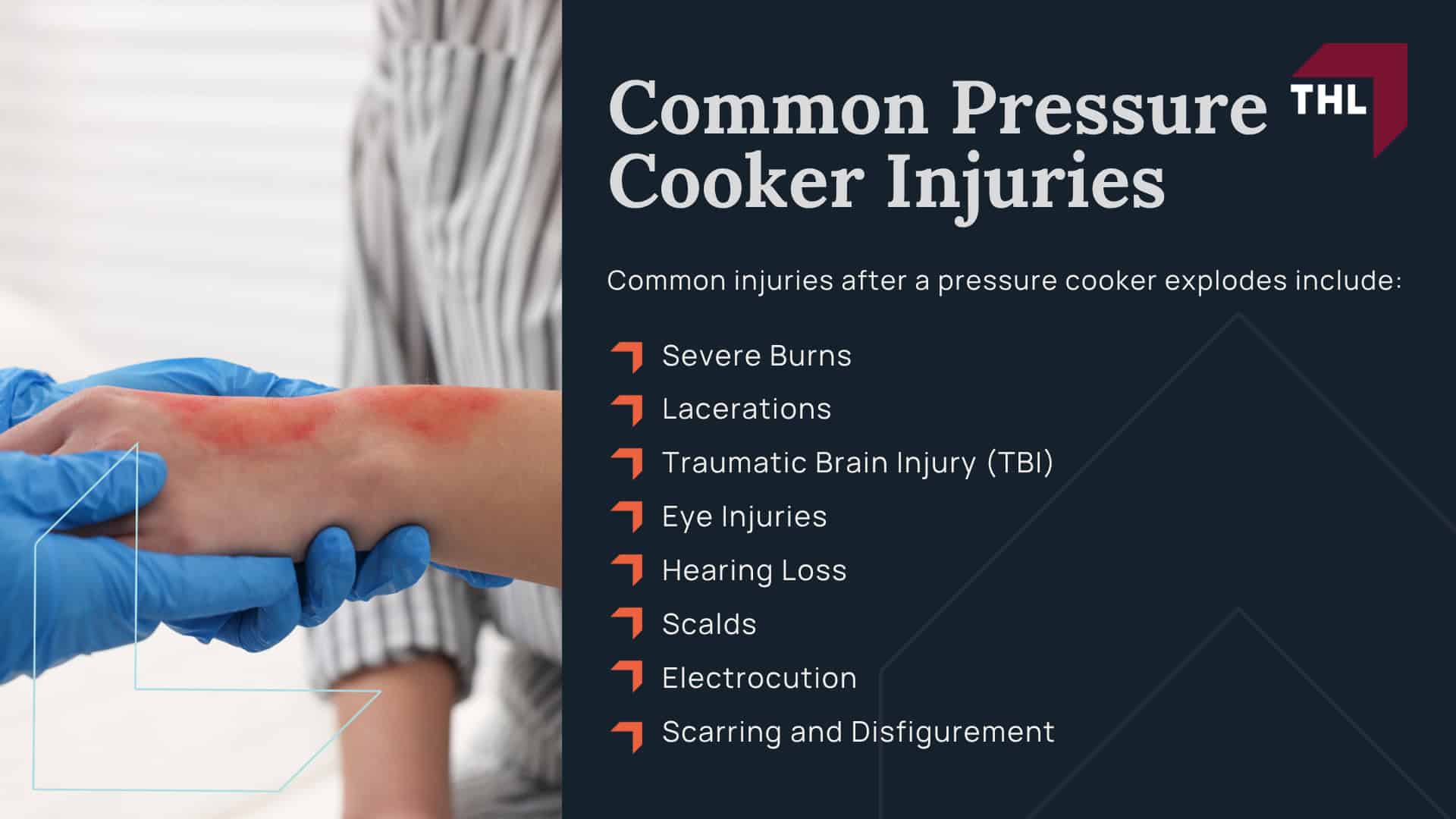 What Causes a Pressure Cooker to Explode; Common Pressure Cooker Injuries