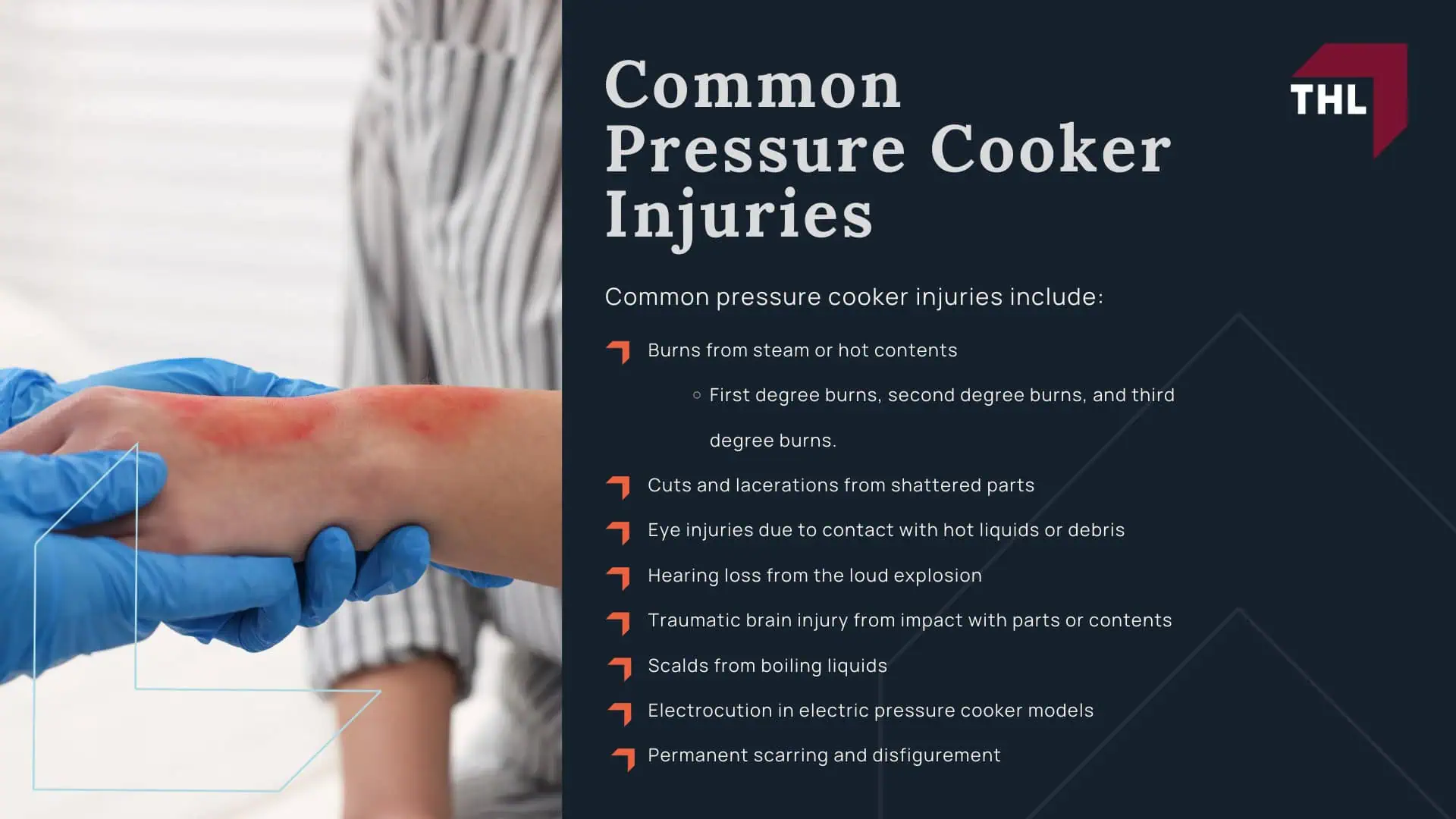 FAQ_ Can I File a Lawsuit for an Instant Pot Explosion_ - Lawsuits for Instant Pot Explosions_ An Overview; FAQ_ Can I File a Lawsuit for an Instant Pot Explosion_ - What is the Point of Filing an Instant Pot Lawsuit; How Do Pressure Cooker Explosions Occur; Common Defects in Faulty Pressure Cookers; Safety Mechanisms Introduced by Pressure Cooker Manufacturers; Common Pressure Cooker Injuries