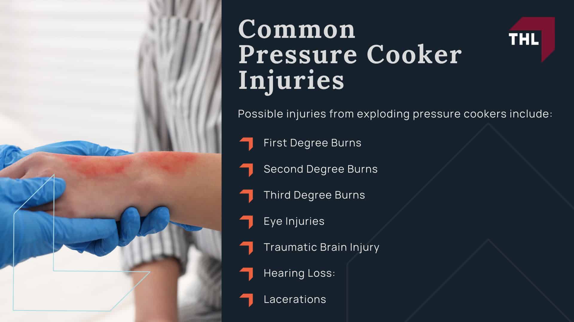 FAQ Can I File a Lawsuit for a Pressure Cooker Explosion - Lawsuits for Pressure Cooker Explosions and Injuries - torhoerman law; FAQ Can I File a Lawsuit for a Pressure Cooker Explosion - Why Do Defective Pressure Cookers Explode - torhoerman law; FAQ Can I File a Lawsuit for a Pressure Cooker Explosion - Common Pressure Cooker Injuries - torhoerman law