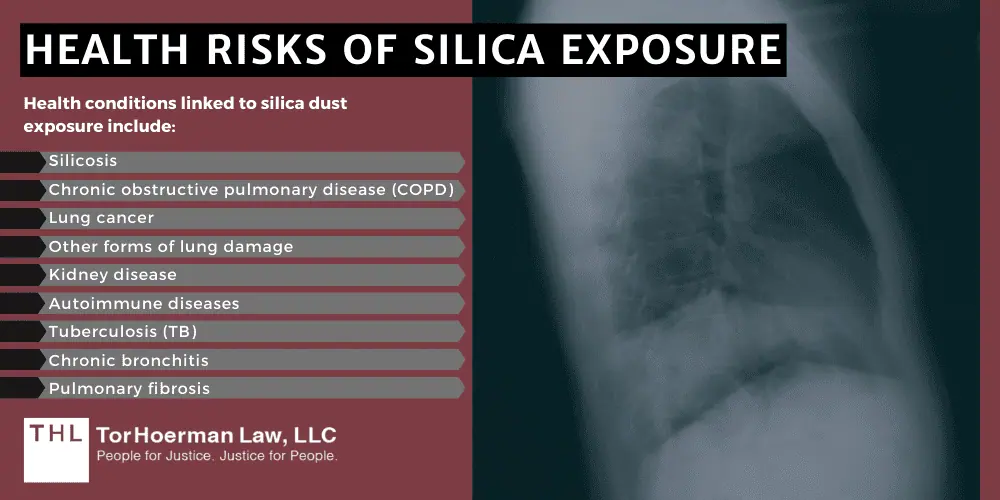 Silicosis Lawsuit; Silica Dust Exposure; Silica Exposure Lawsuit; Silica Lawsuit; Silicosis Lawsuit Overview; What Is The Average Silicosis Lawsuit Settlement Amount; Who Are Silicosis Lawsuits Filed Against;  Health Risks Of Silica Exposure