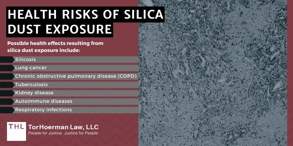 Silicosis Lawsuit Settlement Amounts; Silicosis Lawsuits; Silicosis Lawyers; Silica Dust Exposure Lawsuit; Silicosis Lawsuit Settlement Amounts; Silicosis Lawsuit Overview; What Is Silicosis; What Is The Treatment For A Silicosis Diagnosis; Silicosis Lawsuit Settlement Amounts; Silicosis Lawsuits; Silicosis Lawyers; Silica Dust Exposure Lawsuit; Silicosis Lawsuit Settlement Amounts; Silicosis Lawsuit Overview; What Is Silicosis; What Is The Treatment For A Silicosis Diagnosis