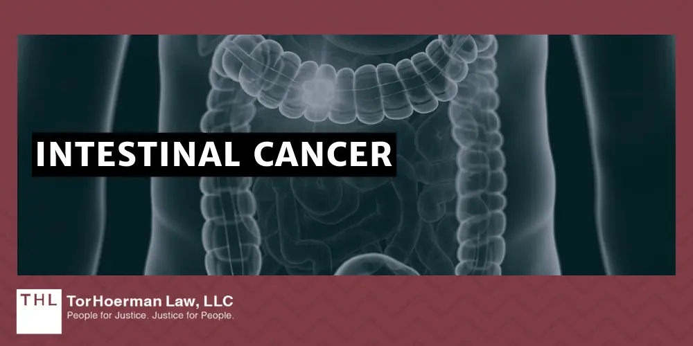 PCBs and Cancer; PCB Lawsuit; Monsanto PCB Lawsuit; Are PCBs Carcinogenic; Do PCBs Cause Cancer; PCB Exposure Lawsuit; Polychlorinated Biphenyls (PCBs) And Cancer; Mechanisms of Carcinogenesis How PCBs Cause Cancer; The Types Of Cancer Linked To PCB Exposures; Liver Cancer; Breast Cancer; Malignant Melanoma; Stomach Cancer; Intestinal Cancer