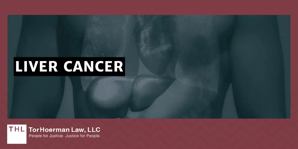 PCBs and Cancer; PCB Lawsuit; Monsanto PCB Lawsuit; Are PCBs Carcinogenic; Do PCBs Cause Cancer; PCB Exposure Lawsuit; Polychlorinated Biphenyls (PCBs) And Cancer; Mechanisms of Carcinogenesis How PCBs Cause Cancer; The Types Of Cancer Linked To PCB Exposures; Liver Cancer