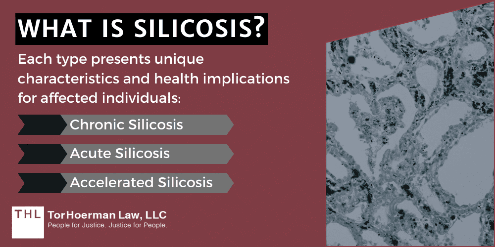 What Is Silicosis