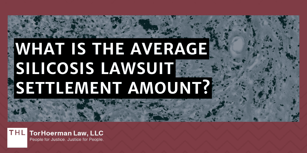 What Is The Average Silicosis Lawsuit Settlement Amount