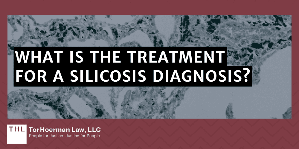 What Is The Treatment For A Silicosis Diagnosis