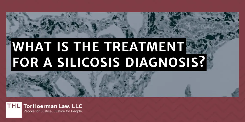 What Is The Treatment For A Silicosis Diagnosis