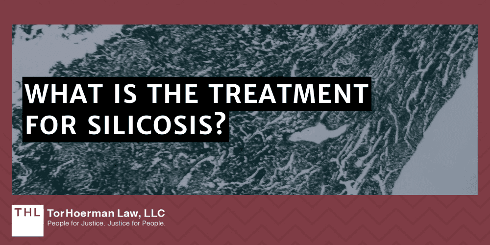 What Is The Treatment For Silicosis