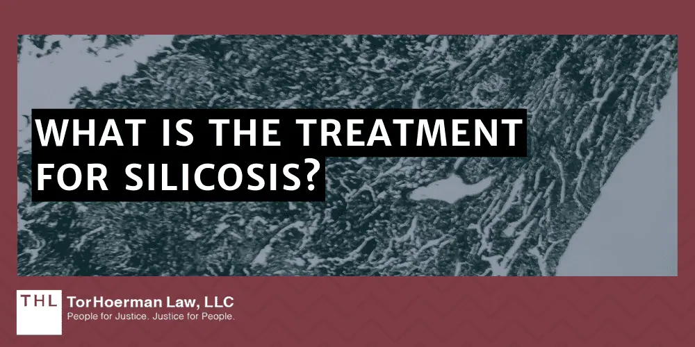 Silicosis Lawsuit; Silica Dust Exposure; Silica Exposure Lawsuit; Silica Lawsuit; Silicosis Lawsuit Overview; What Is The Average Silicosis Lawsuit Settlement Amount; Who Are Silicosis Lawsuits Filed Against;  Health Risks Of Silica Exposure; What Is Silicosis; Common Silicosis Symptoms; Silicosis Complications; Chronic Silicosis Vs. Acute Silicosis; What Is The Treatment For Silicosis