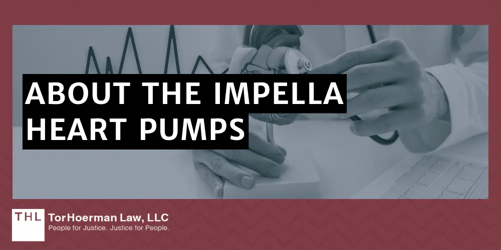 Impella 2.5
Impella CP
Impella CP with SmartAssist
Impella 5.5 with SmartAssist
Impella LD; Abiomed Impella Heart Pumps Recalled Due to Deaths and Serious Injuries; Impella Heart Pump Recalls And Regulatory Action (2023 & 2024); Abiomed Updates Patient Safety Instructions; About The Impella Heart Pumps