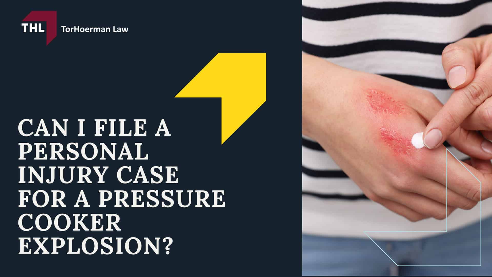 How and Why Do Pressure Cooker Explosions Occur; Common Pressure Cooker Defects that Lead to Explosions; Common Injuries Linked to Pressure Cooker Explosions; Can I File a Personal Injury Case for a Pressure Cooker Explosion