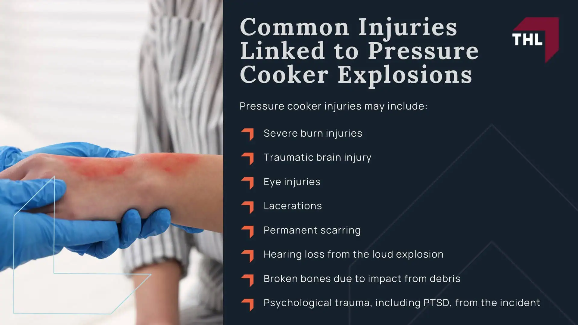 FAQ_ Can Pressure Cookers Explode - How and Why Do Pressure Cooker Explosions Occur_ - torhoerman law; FAQ_ Can Pressure Cookers Explode - Common Pressure Cooker Defects that Lead to Explosions - torhoerman law; FAQ_ Can Pressure Cookers Explode - Common Injuries Linked to Pressure Cooker Explosions - torhoerman law