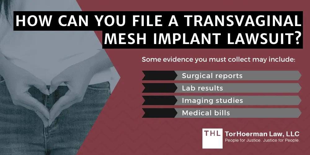 How Can You File A Transvaginal Mesh Implant Lawsuit