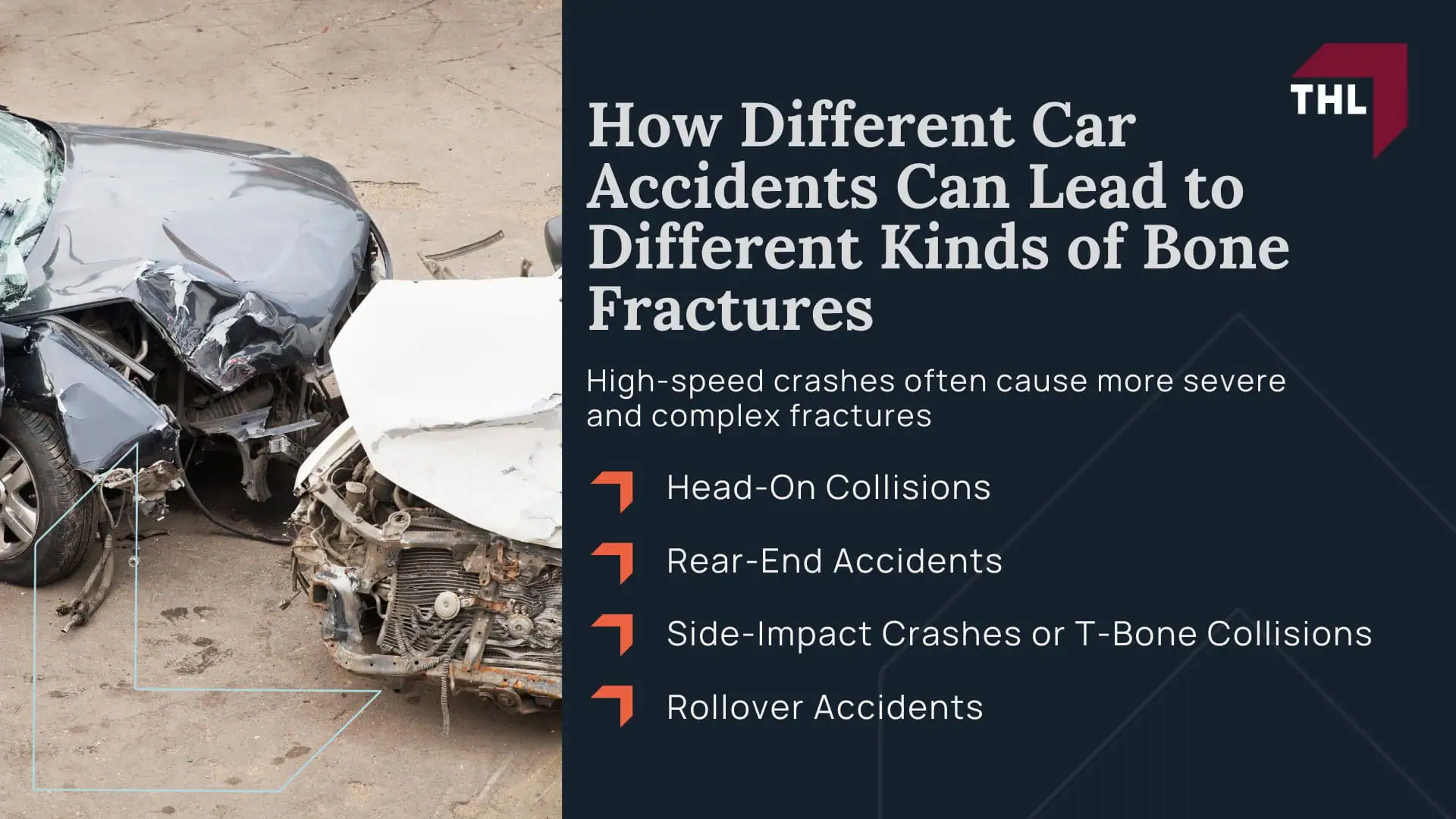 How Different Car Accidents Can Lead to Different Kinds of Bone Fractures