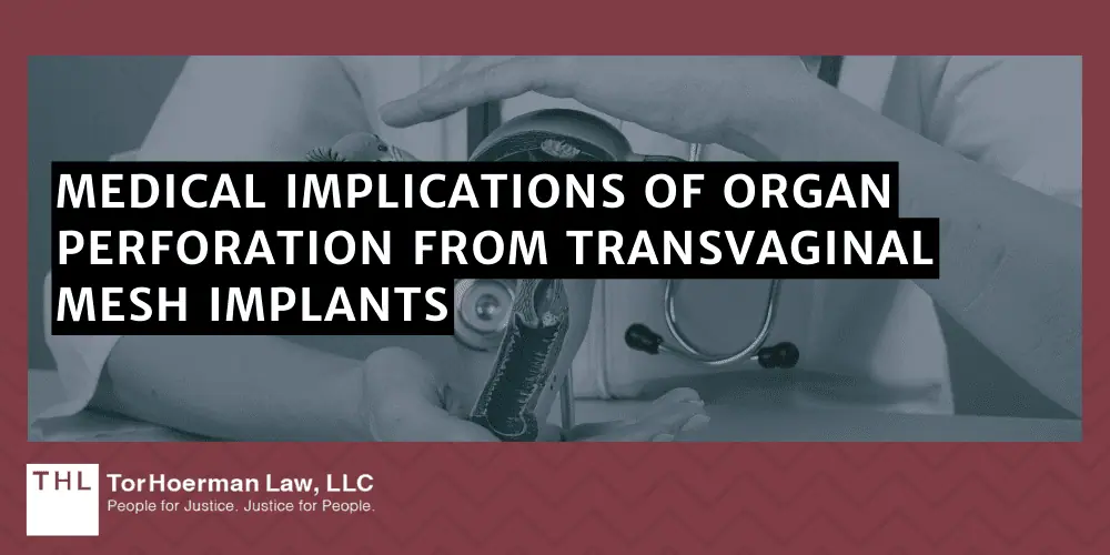 Medical Implications Of Organ Perforation From Transvaginal Mesh Implants