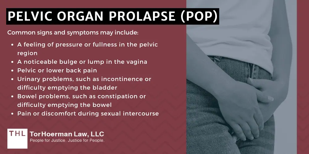 Pelvic Organ Prolapse (POP)