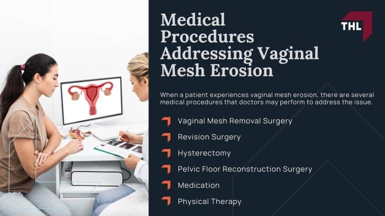 Mesh Excision Vaginal Mesh Erosion Lawsuit | 2026 Update