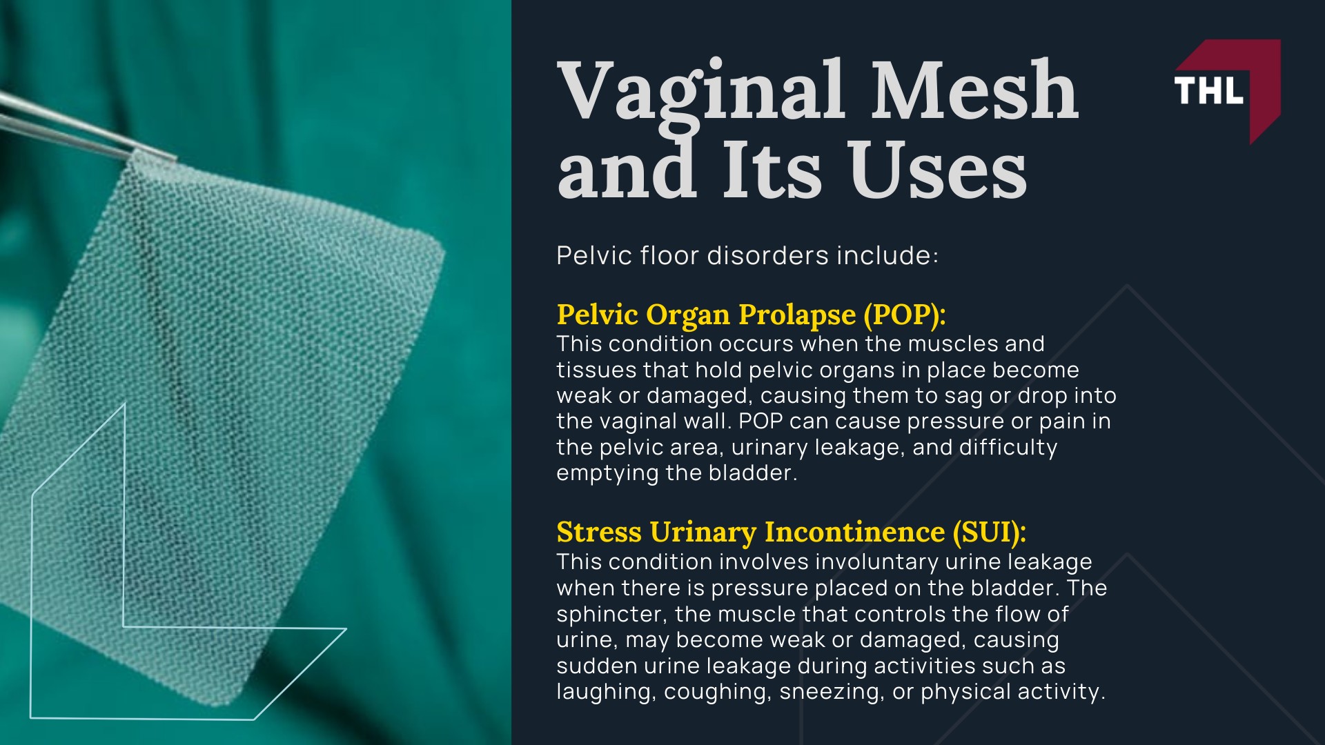 Vaginal Mesh Erosion Lawsuit - Vaginal Mesh and Its Uses - torhoerman law