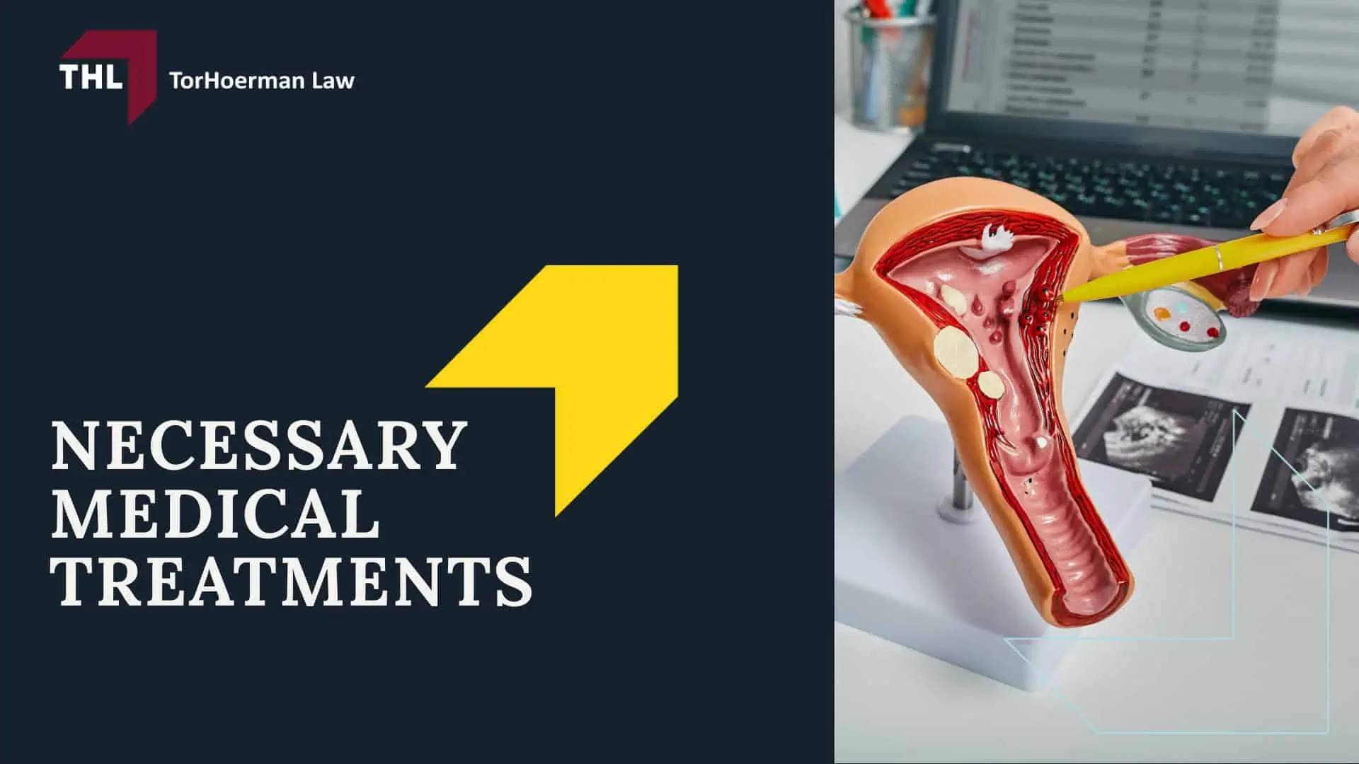 Vaginal Mesh Infection Lawsuit - What Is Vaginal Mesh - torhoerman law; Vaginal Mesh Infection Lawsuit - Pelvic Organ Prolapse (POP) - torhoerman law; Vaginal Mesh Infection Lawsuit - Stress Urinary Incontinence (SUI) - torhoerman law; Vaginal Mesh Infection Lawsuit - Understanding Vaginal Mesh Infection - torhoerman law; Vaginal Mesh Infection Lawsuit - Causes of Vaginal Mesh Complications That Lead to Infection - torhoerman law; Vaginal Mesh Infection Lawsuit - Symptoms of Vaginal Mesh Infection - torhoerman law; Vaginal Mesh Infection Lawsuit - The Potential Severity of Vaginal Mesh Infections - torhoerman law; Vaginal Mesh Infection Lawsuit - The Health Implications of Vaginal Mesh Infections - torhoerman law; Vaginal Mesh Infection Lawsuit - Necessary Medical Treatments - torhoerman law