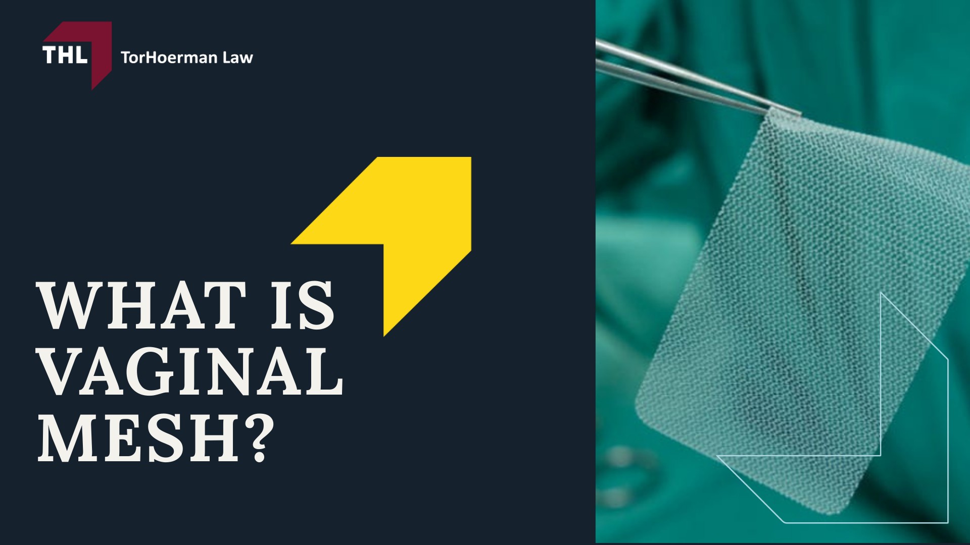 Vaginal Mesh Infection Lawsuit - What Is Vaginal Mesh - torhoerman law