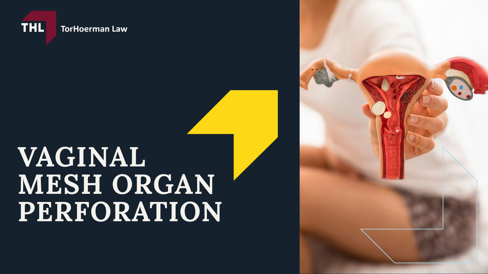 Vaginal Mesh Organ Perforation Lawsuit - On the Use of Vaginal Mesh - torhoerman law; Vaginal Mesh Organ Perforation Lawsuit - What is the Purpose of Transvaginal Mesh - torhoerman law; Vaginal Mesh Organ Perforation Lawsuit - The Applications of Transvaginal Mesh - torhoerman law; Vaginal Mesh Organ Perforation Lawsuit - 2019 Ban by the Food and Drug Administration - torhoerman law; Vaginal Mesh Organ Perforation Lawsuit - Vaginal Mesh Organ Perforation - torhoerman law