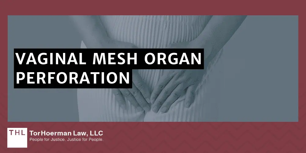 Vaginal Mesh Organ Perforation
