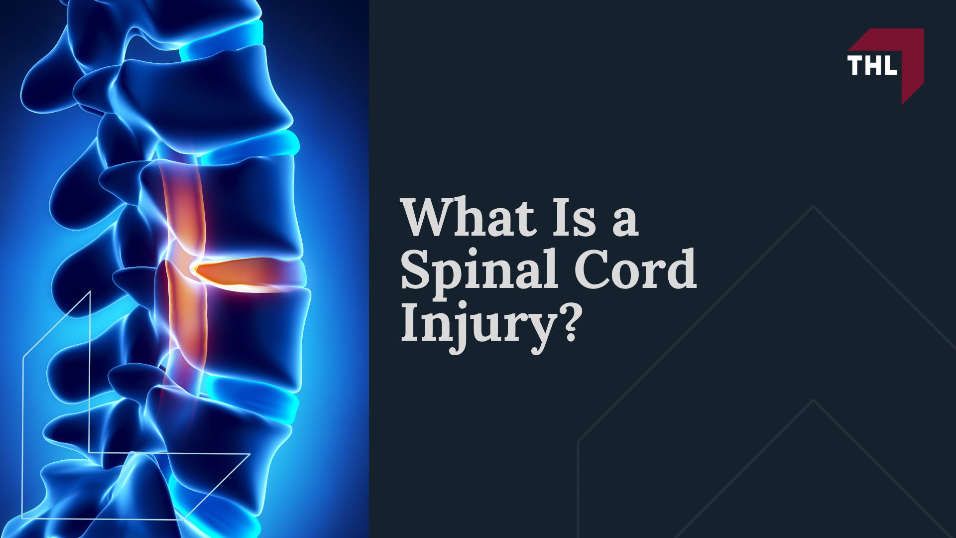 What Is a Spinal Cord Injury
