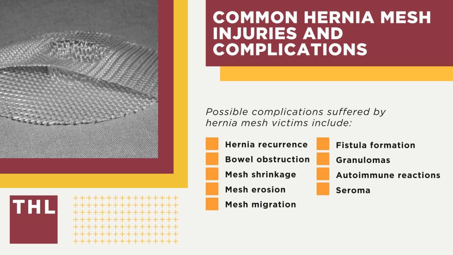 Hernia Mesh Lawsuit Settlement Amounts July 2026