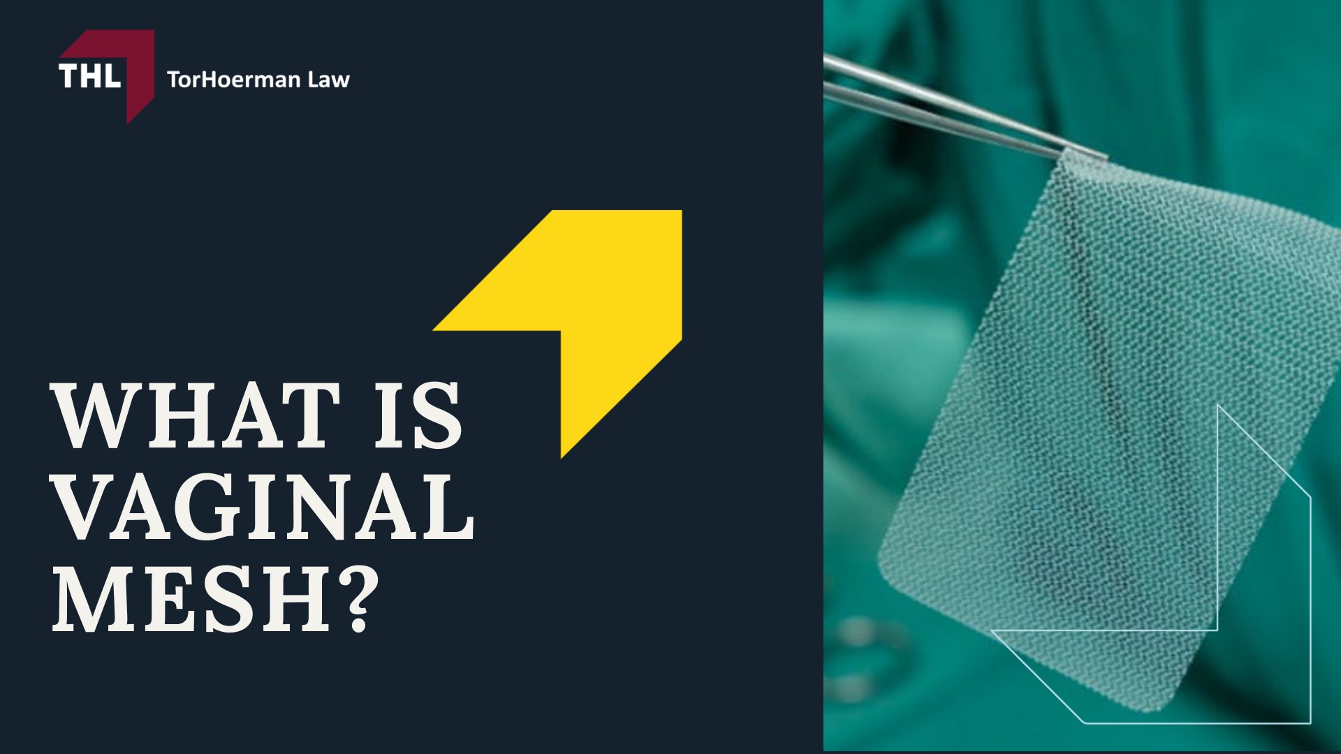 Vaginal Mesh Pelvic Pain Lawsuit - What Is Vaginal Mesh - torhoerman law