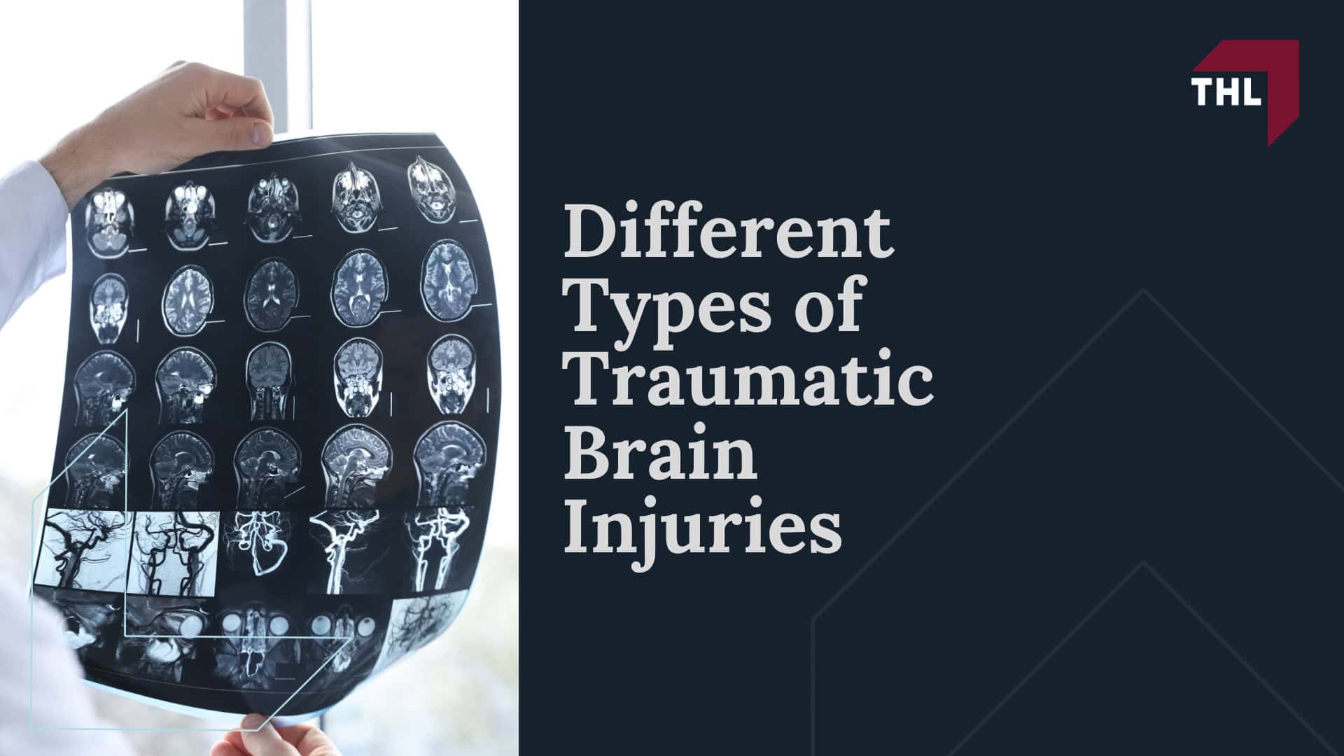 The Profound Impact of Brain Injuries; Different Types of Traumatic Brain Injuries