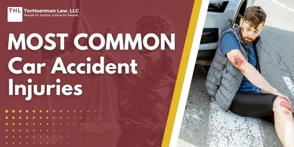 Most Common Car Accident Injuries; Common Car Accident Injuries; The Catastrophic and Lasting Impact of Car Crash Injuries; Different Accidents and Injury Patterns; Wrongful Death Claims After Car Accidents; What an Attorney Can Do for Your Car Accident Claim; Compensation for Your Injuries_ We're Here for You