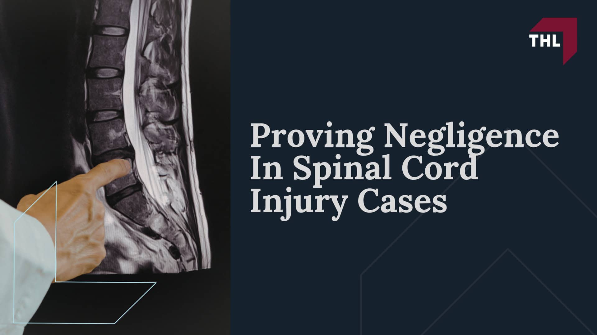 Lawyers For Spinal Cord Injuries in Edwardsville; Types of Spinal Cord Injuries; Navigating Challenges in Spinal Cord Injury Cases; Lawyers For Spinal Cord Injuries in Edwardsville; Types of Spinal Cord Injuries; Navigating Challenges in Spinal Cord Injury Cases; How Can a Personal Injury Lawyer Help You; Do You Qualify for an Edwardsville Spinal Cord Injury Lawsuit; Navigating Challenges in Spinal Cord Injury Cases (2)