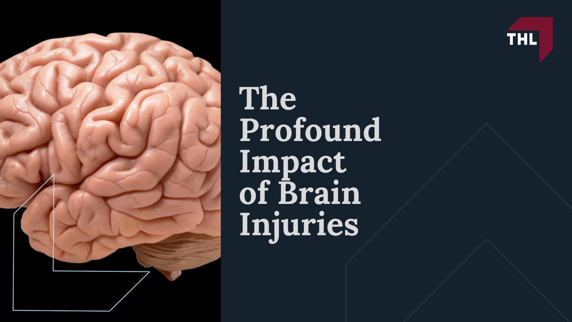 The Profound Impact of Brain Injuries