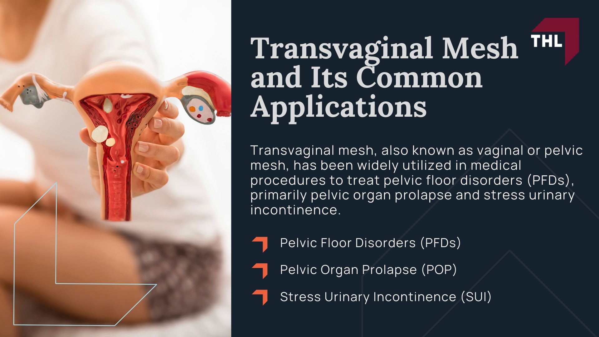Vaginal Mesh Lawsuit Update - Transvaginal Mesh and Its Common Applications - torhoerman law