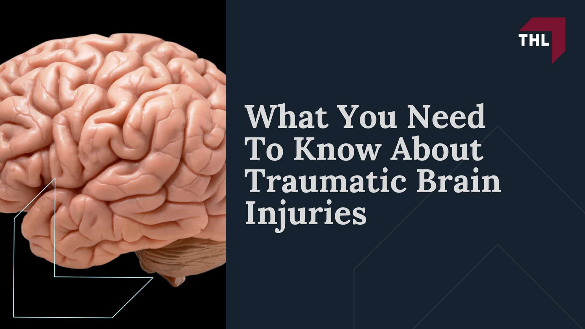 What You Need To Know About Traumatic Brain Injuries