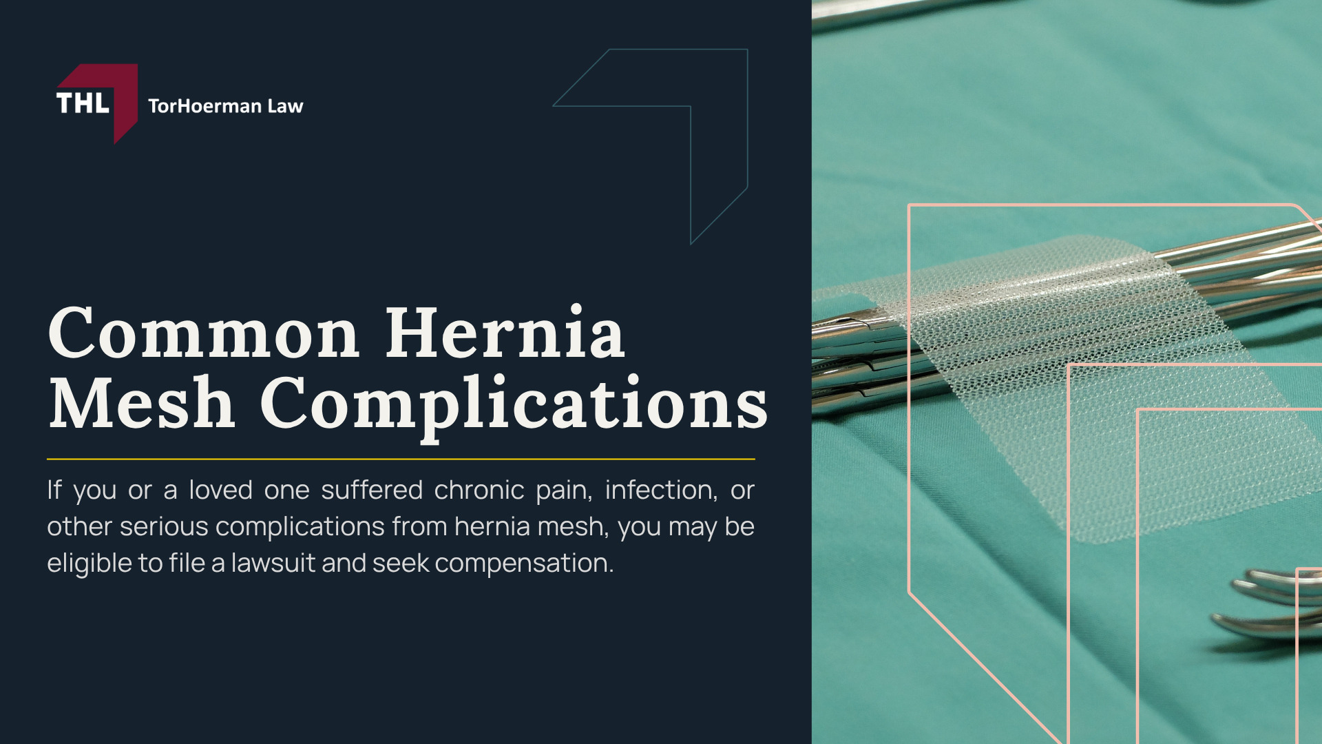 Common Hernia Mesh Complications; The Use of Surgical Mesh in Hernia Repair Surgery; The Use of Surgical Mesh in Hernia Repair Surgery; Impact of Hernia Mesh Complication; Treatment Options for Hernia Mesh Complications; Legal Implications of Hernia Mesh Complications; Seeking Legal Help; What Are the Most Common Hernia Mesh Complications; What Are the Most Common Hernia Mesh Complications (2); How Are Hernia Mesh Complications Diagnosed; Treatment for Hernia Mesh Complications; Do Different Types of Hernia Mesh Have Different Complication Risks; Can Hernia Mesh Complications Lead to a Lawsuit; TorHoerman Law_ Speak With Our Hernia Mesh Lawyers